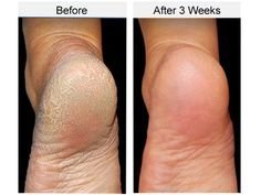 Manteca Corporal de Coco y Lima - Secretos de las Islas