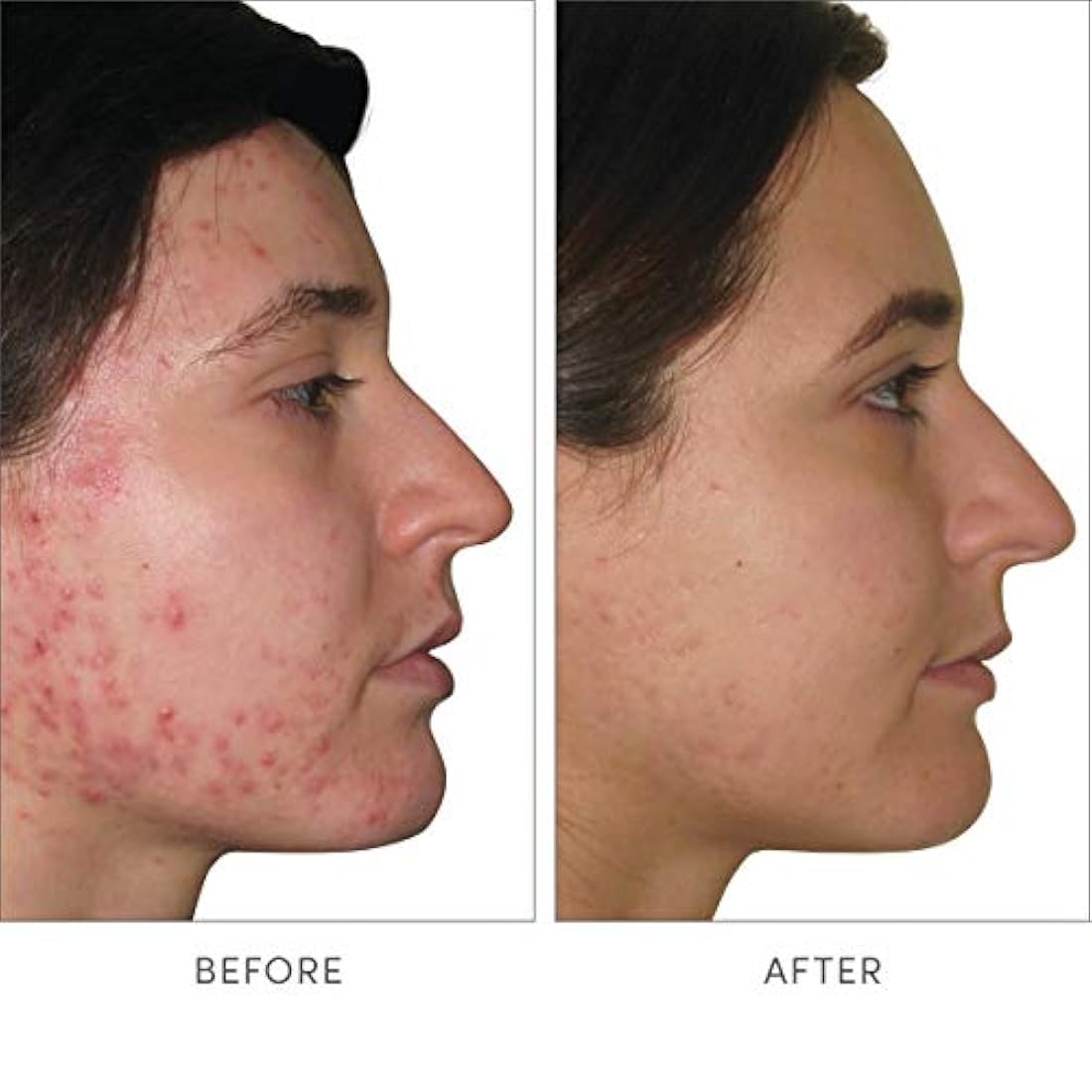 Suplementos Alimenticios, Skin Accumax Cover case Rojo