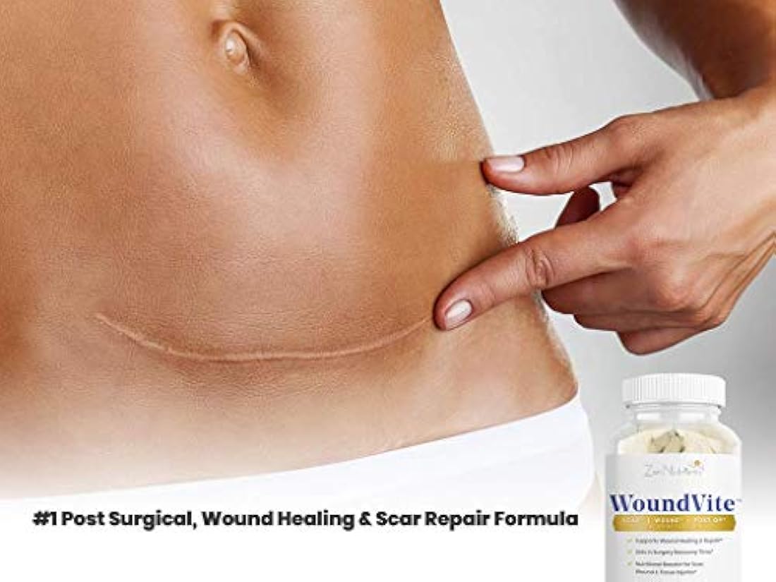 WoundVite – Suplemento de curación de heridas y cicatrices –