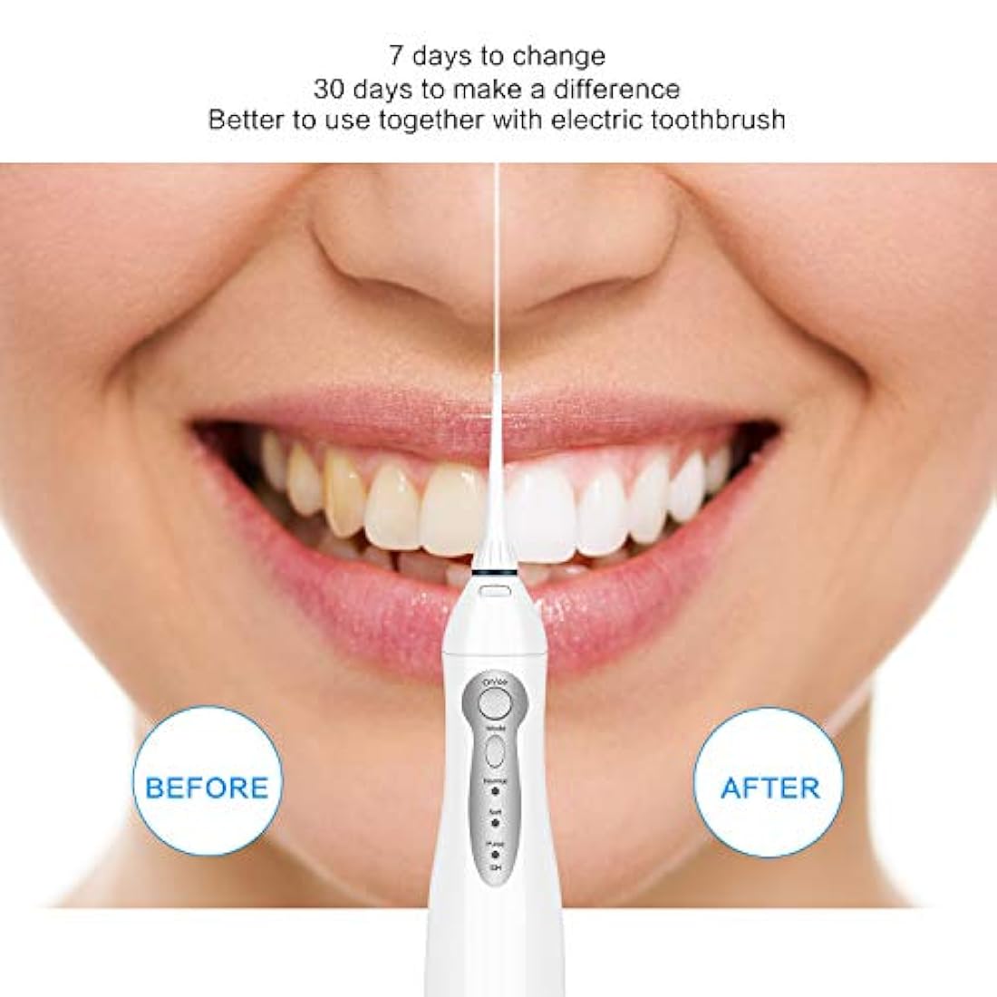 Waterpiks inalámbrico