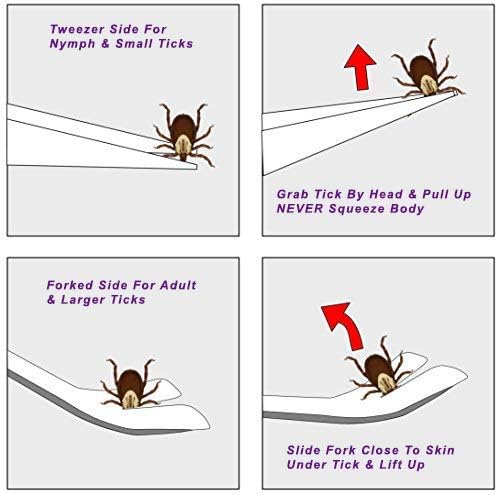 Herramienta para quitar garrapatas eTradewinds, acero inoxidable, 4-Pack