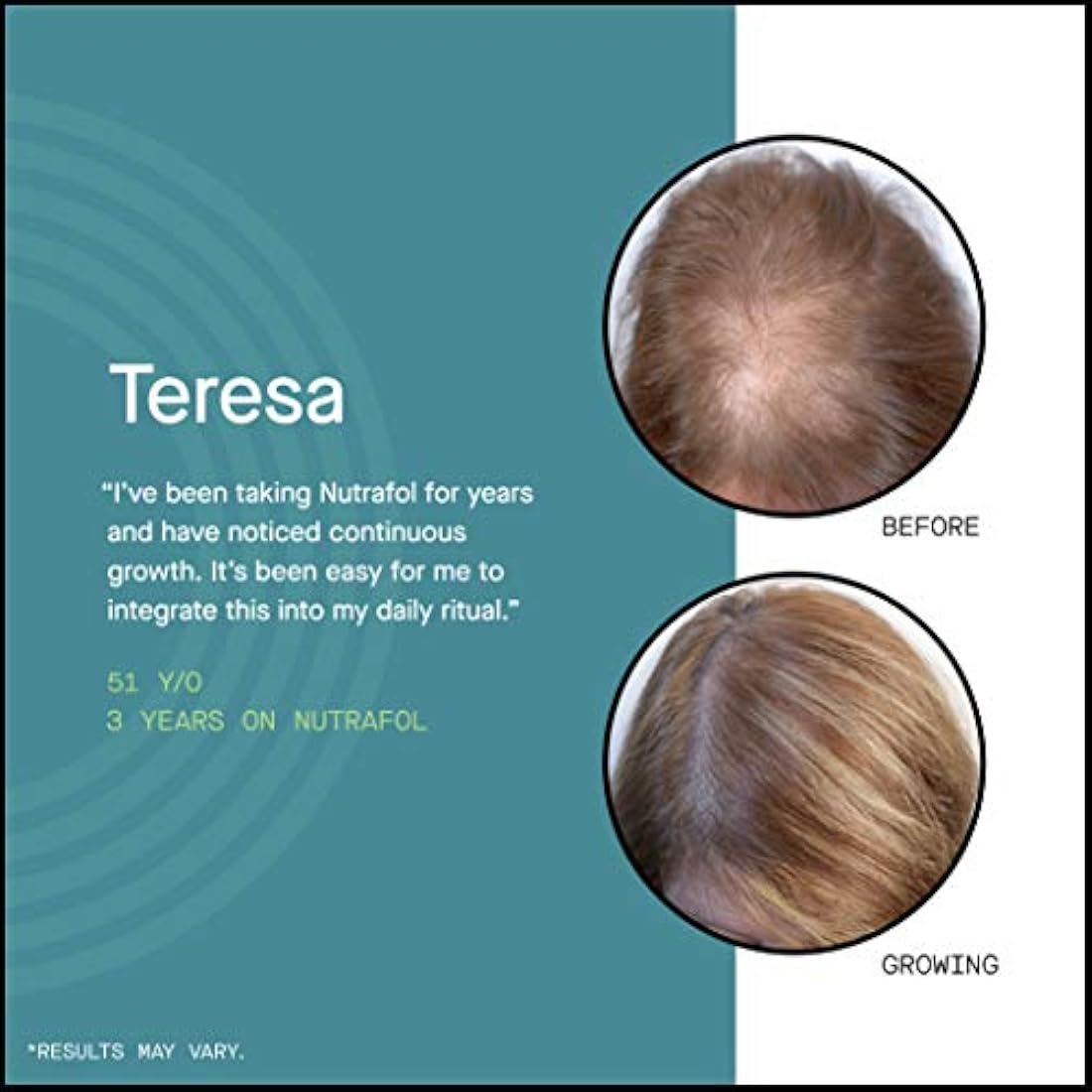 Suplemento para cabello delgado para mujeres 120 cápsulas