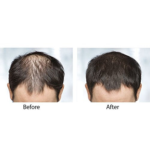 Pastillas para el Crecimiento del Pelo y Barba Fortalece