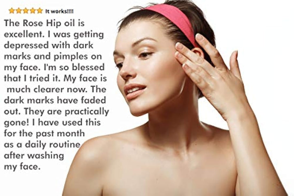 Aceite orgánico de semillas de rosa mosqueta certificada