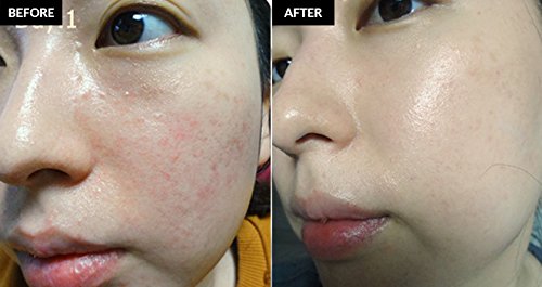 Crema para las manchas faciales