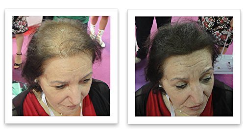 Corrector de pérdida de cabello marrón mediano