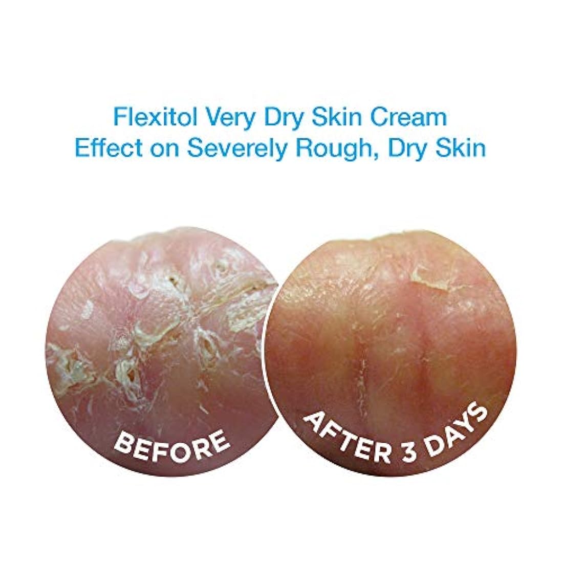 Flexitol Crema corporal para la piel seca, tubo de 4.4oz