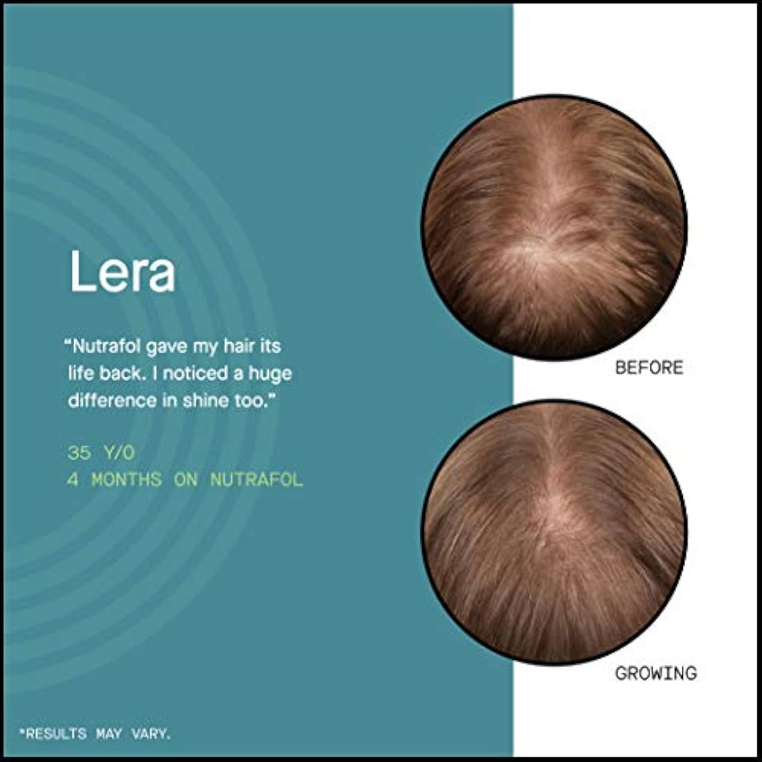 Suplemento para cabello delgado para mujeres 120 cápsulas