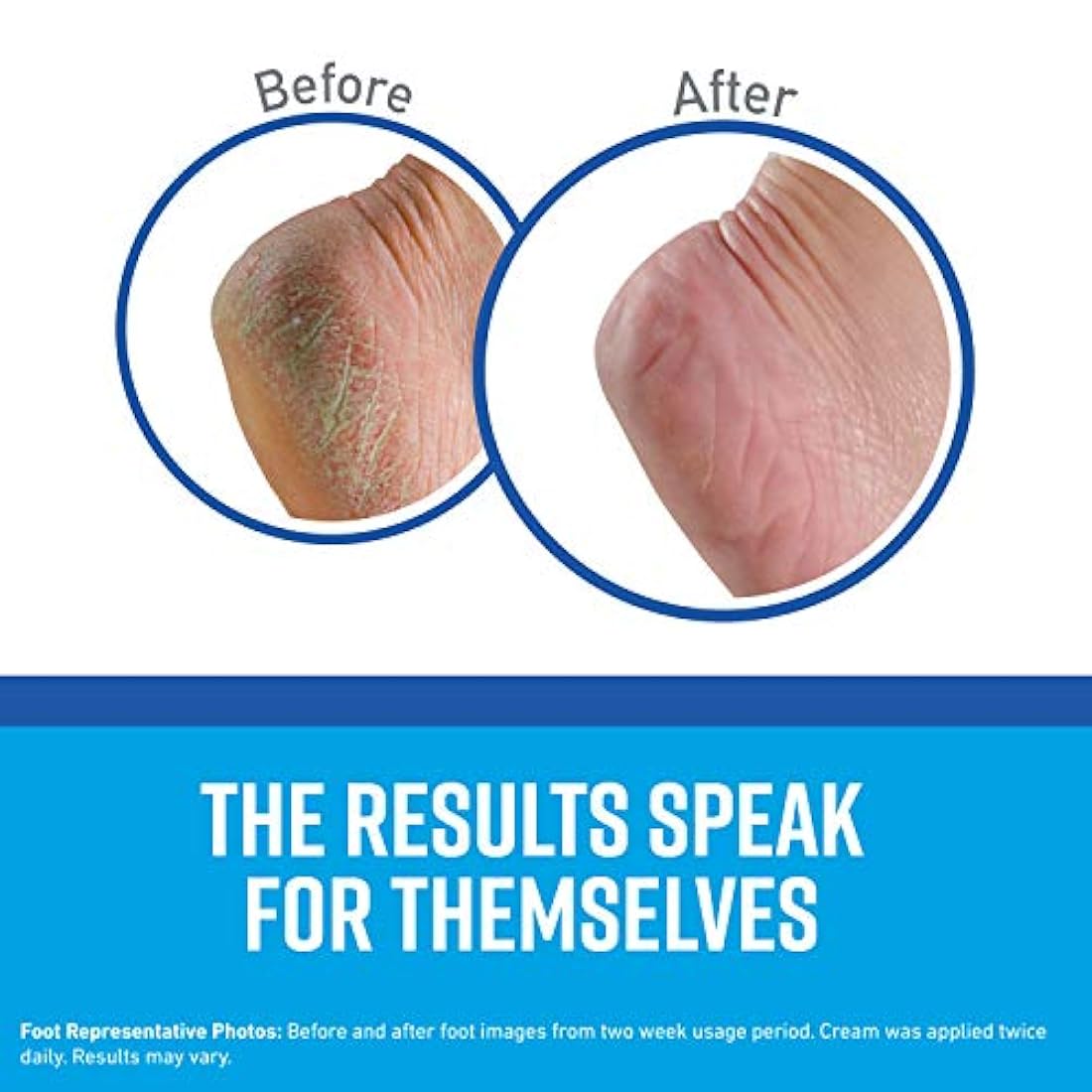 Crema O'Keeffe's para unos pies saludables K0280016