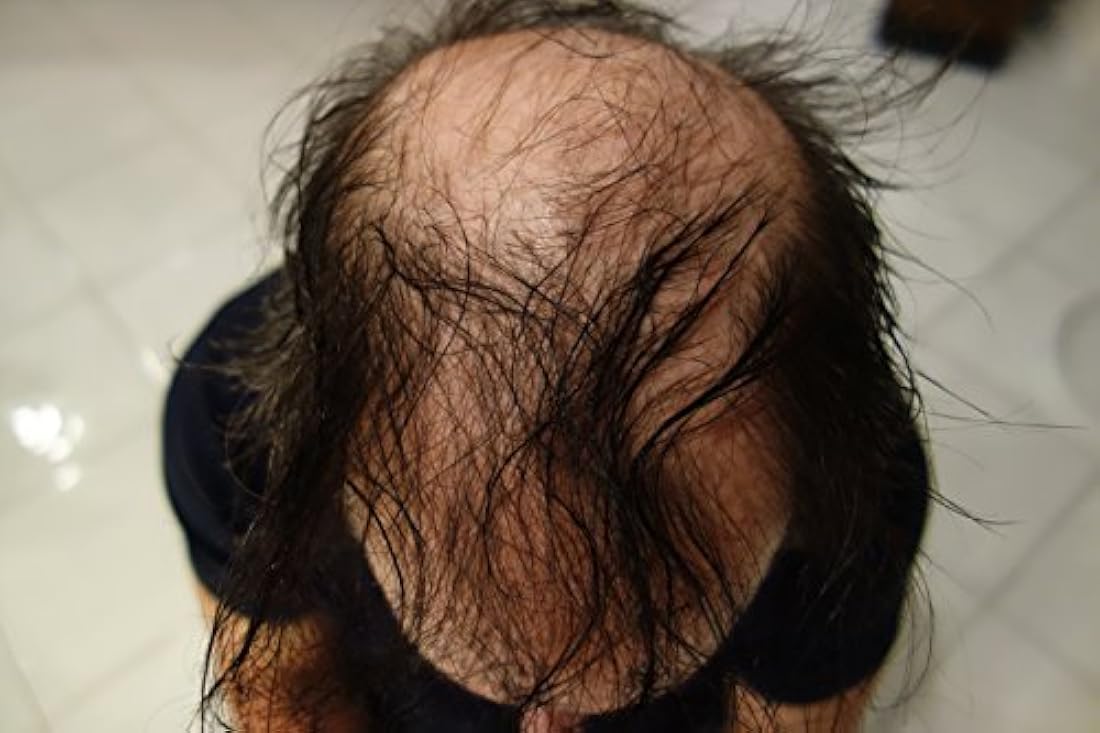 Finallyfibras de queratina para la recontrucción del cabello