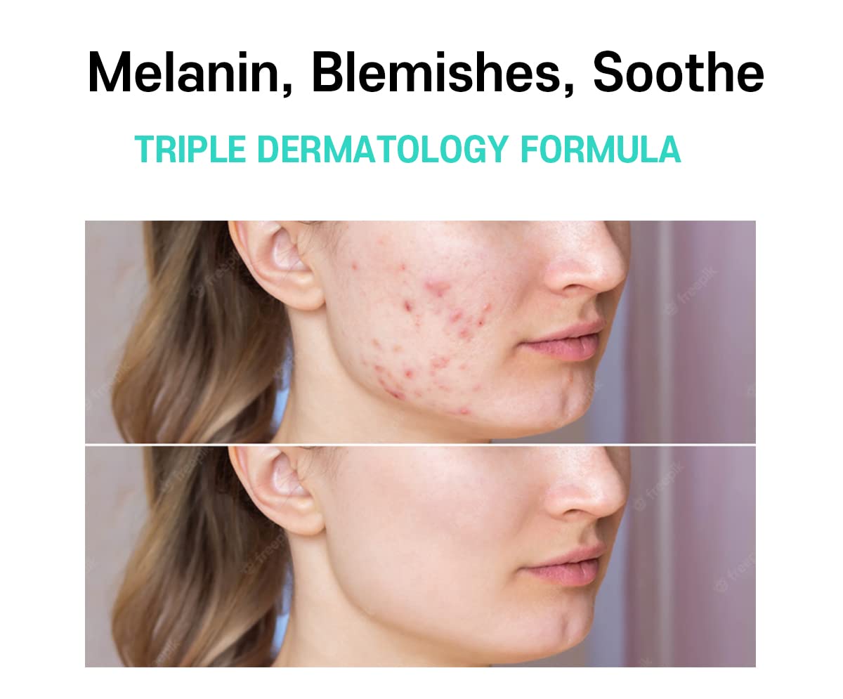Crema Facial para Melasma Centella Asiática Cuidado Coreano
