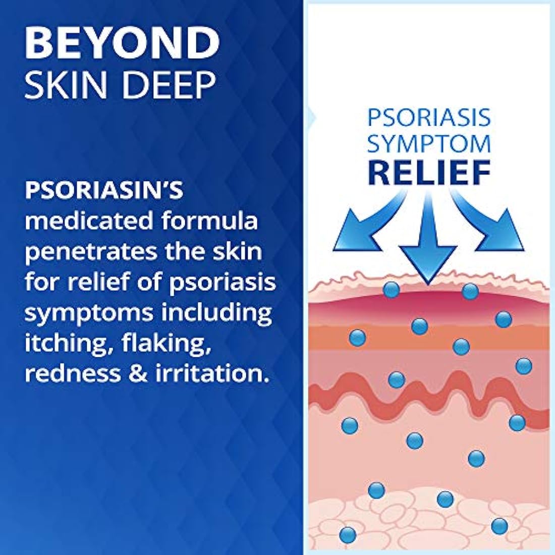 Psoriasina