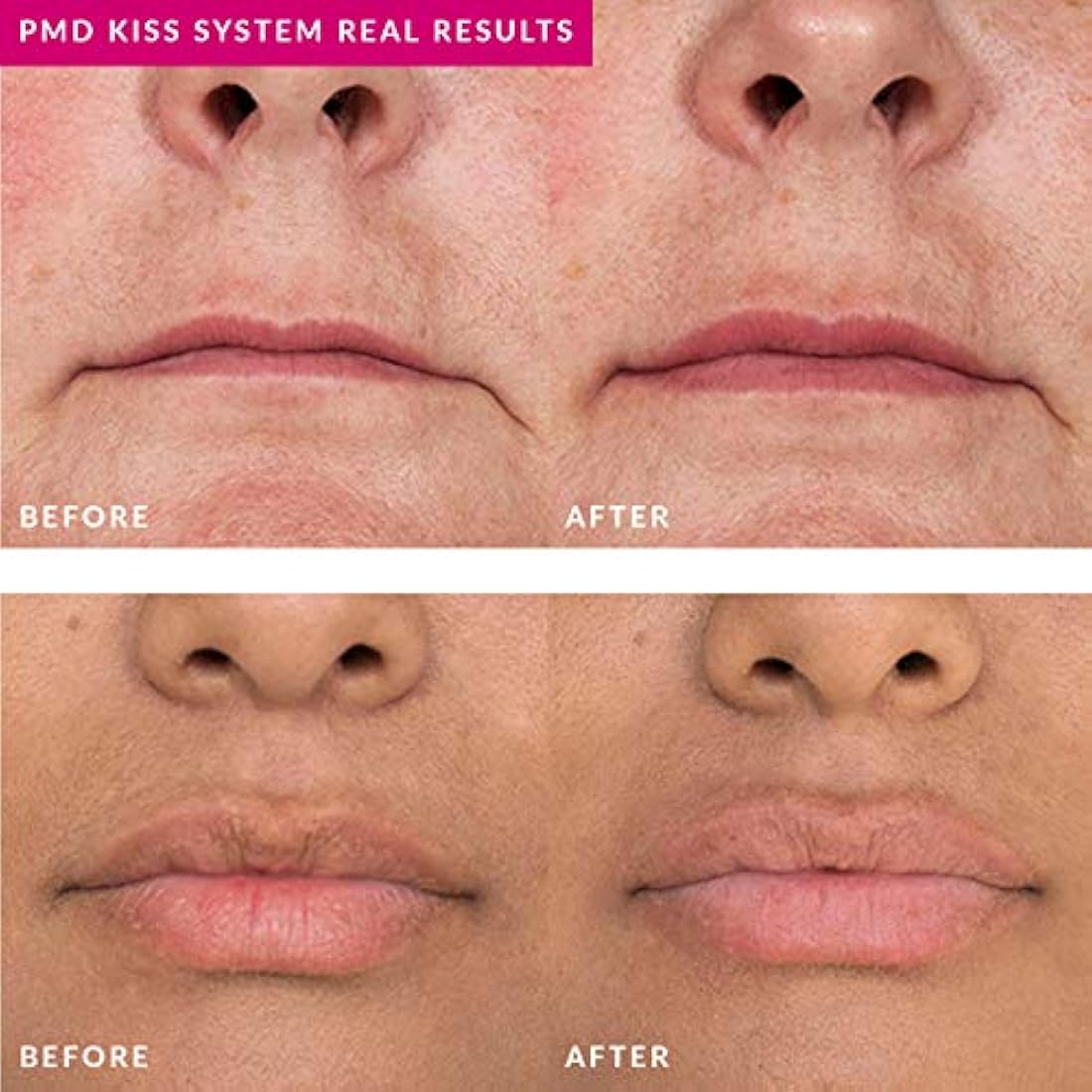 Cuidado Facial ,suero para dar volumen a los labios, 0.36 oz