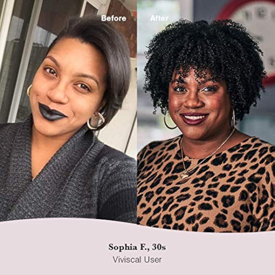 Suplementos para el crecimiento del cabello para mujer