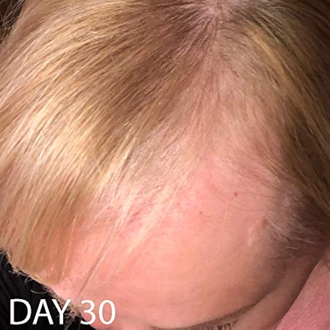 Biotin Vitamina Champú y acondicionador para crecimiento