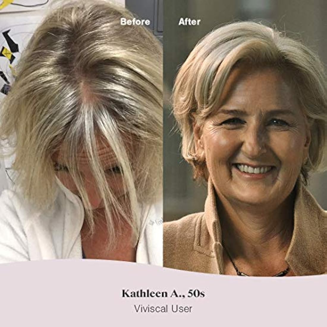 Suplementos para el crecimiento del cabello para mujer