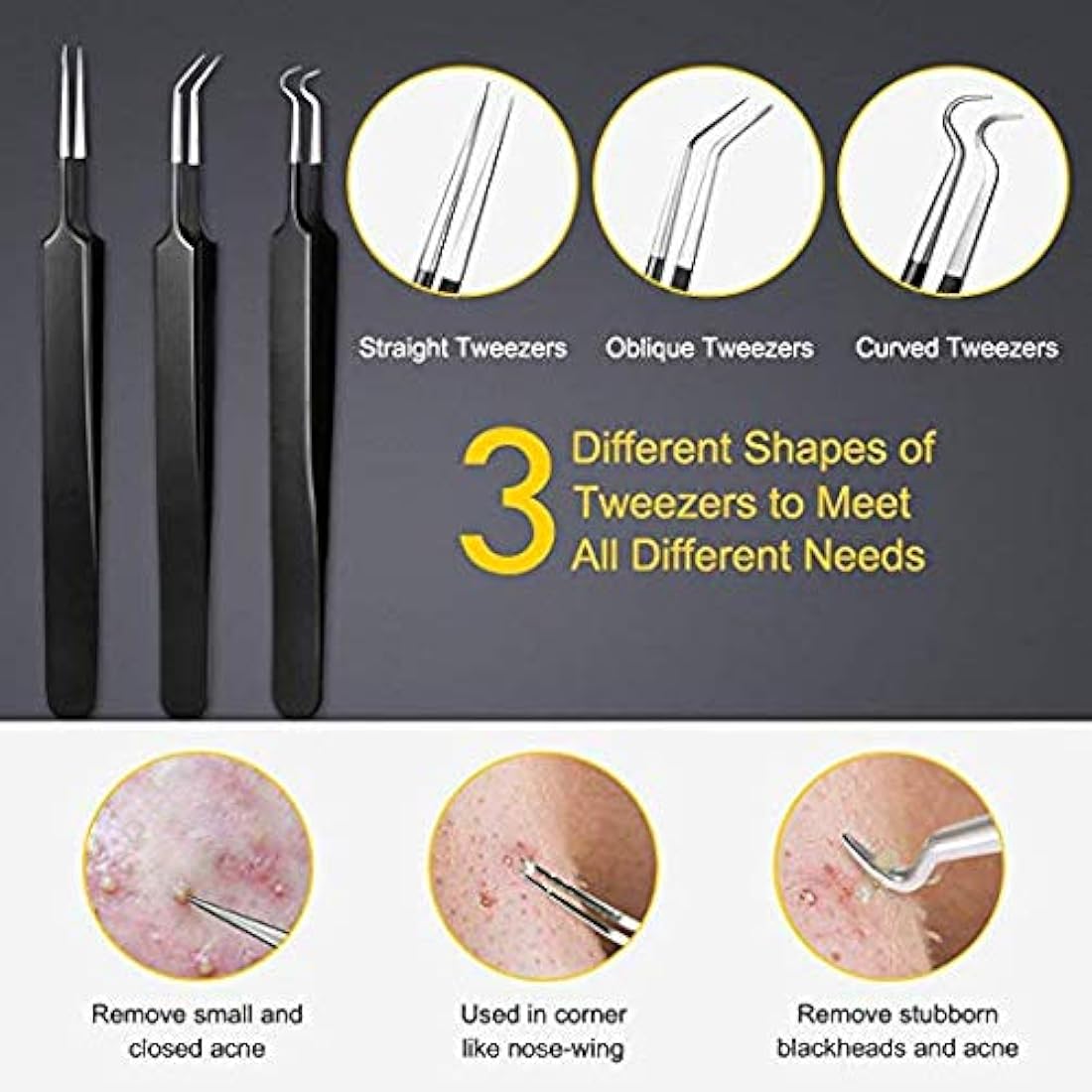 Kit de extracción de espinillas