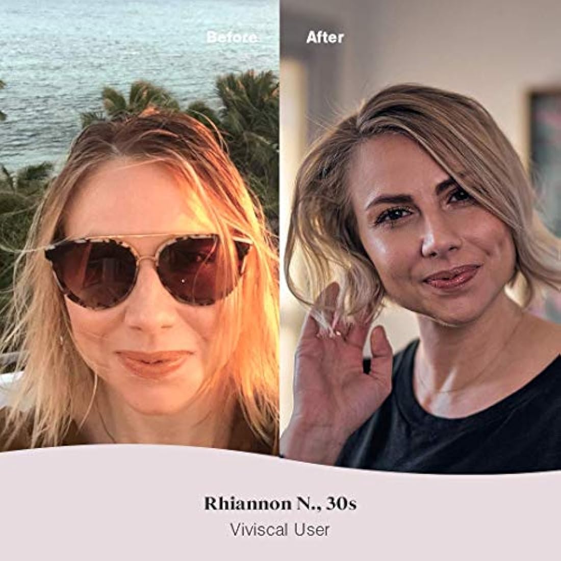 Suplementos para el crecimiento del cabello para mujer