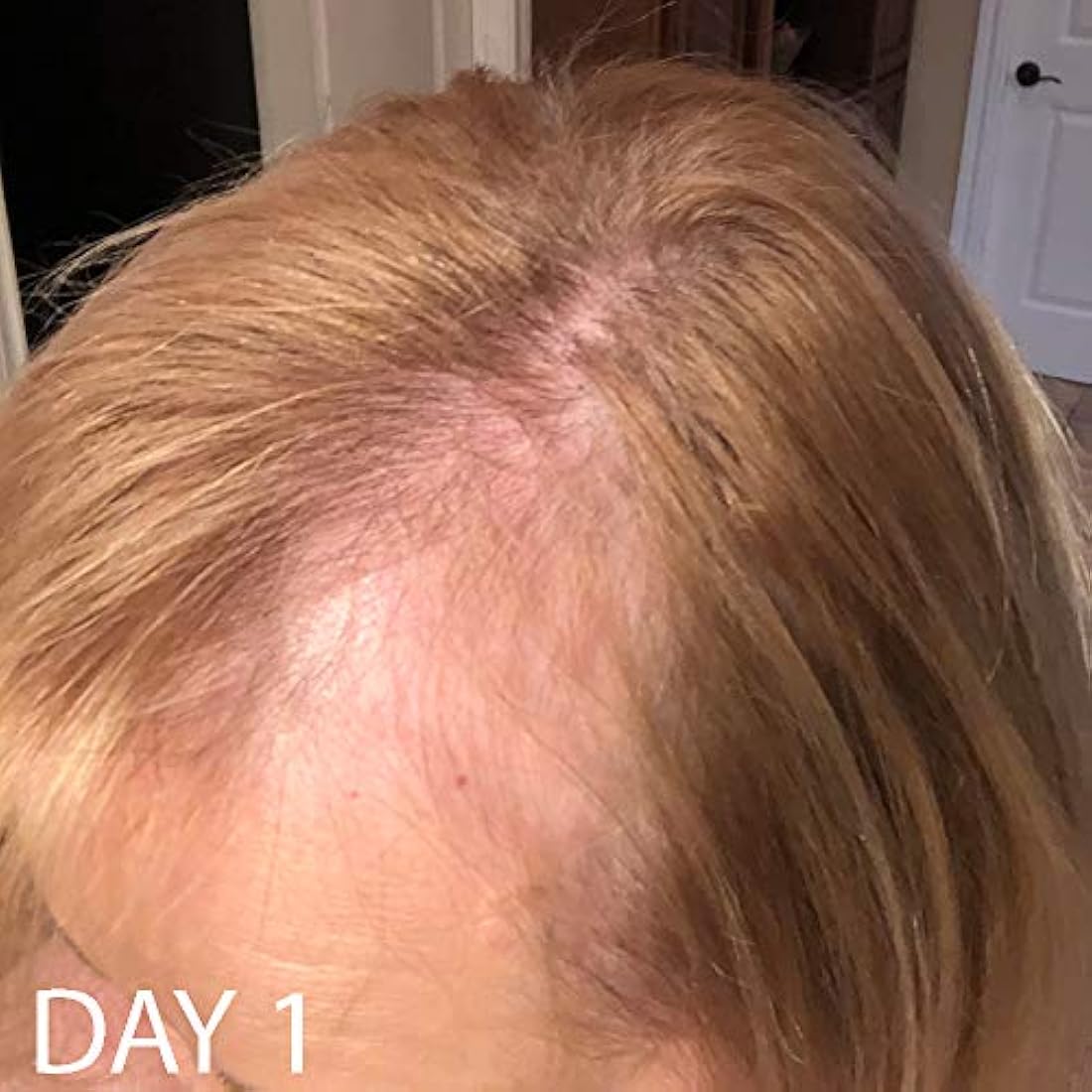 Biotin Vitamina Champú y acondicionador para crecimiento