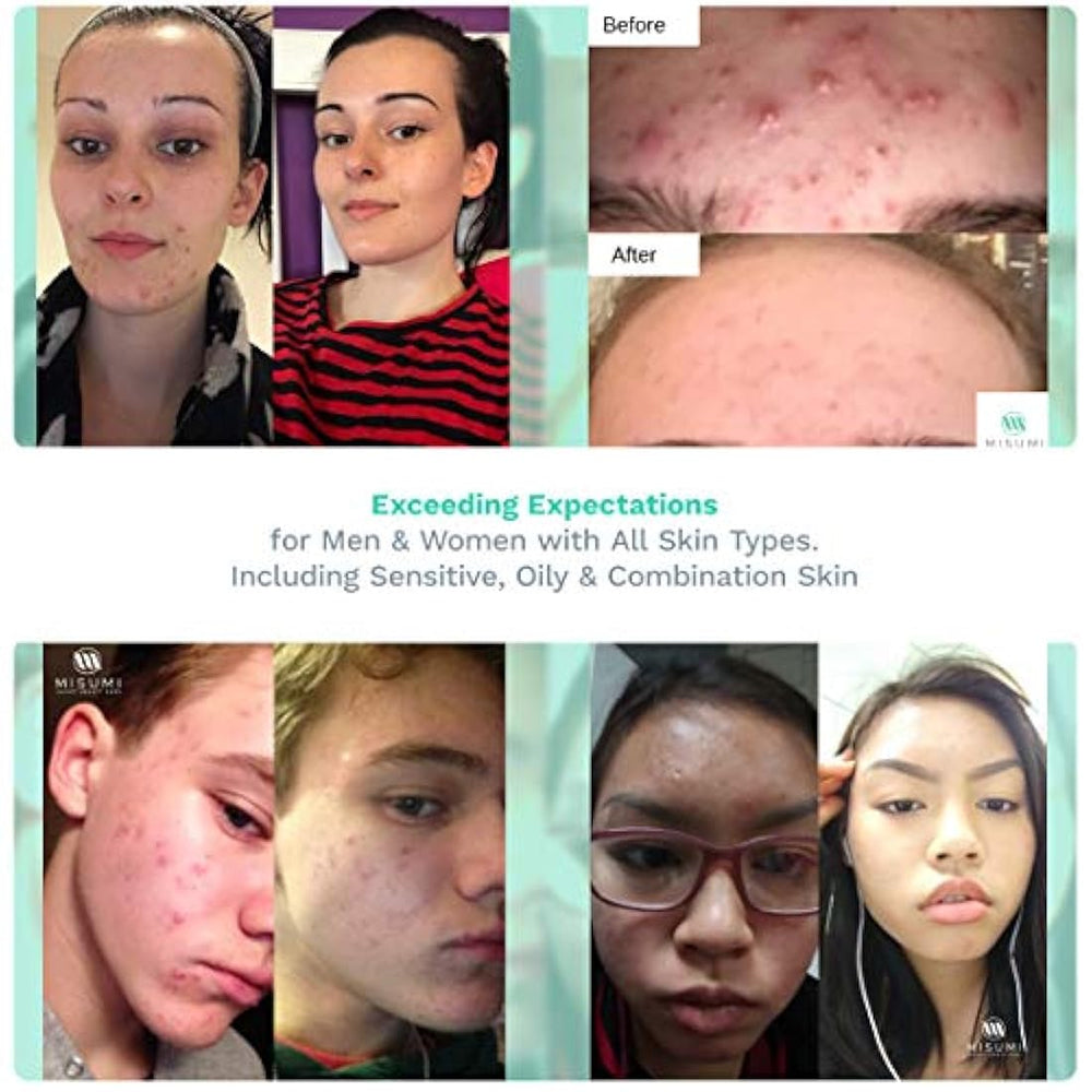 Limpiador  acné con ácido glicólico - Ácido hidroxi alfa 10%