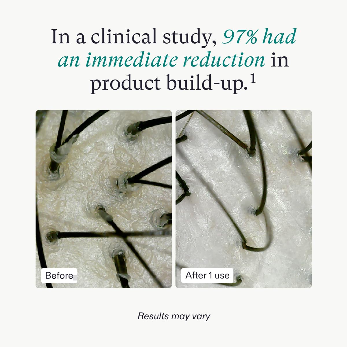 Mascarilla exfoliante para el cuero cabelludo Nutrafol