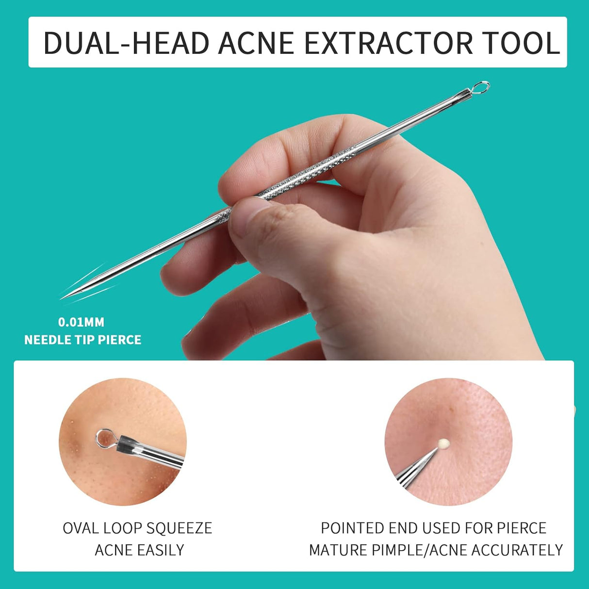 Extractor de espinillas WSYUB, acero inoxidable, kit de acné