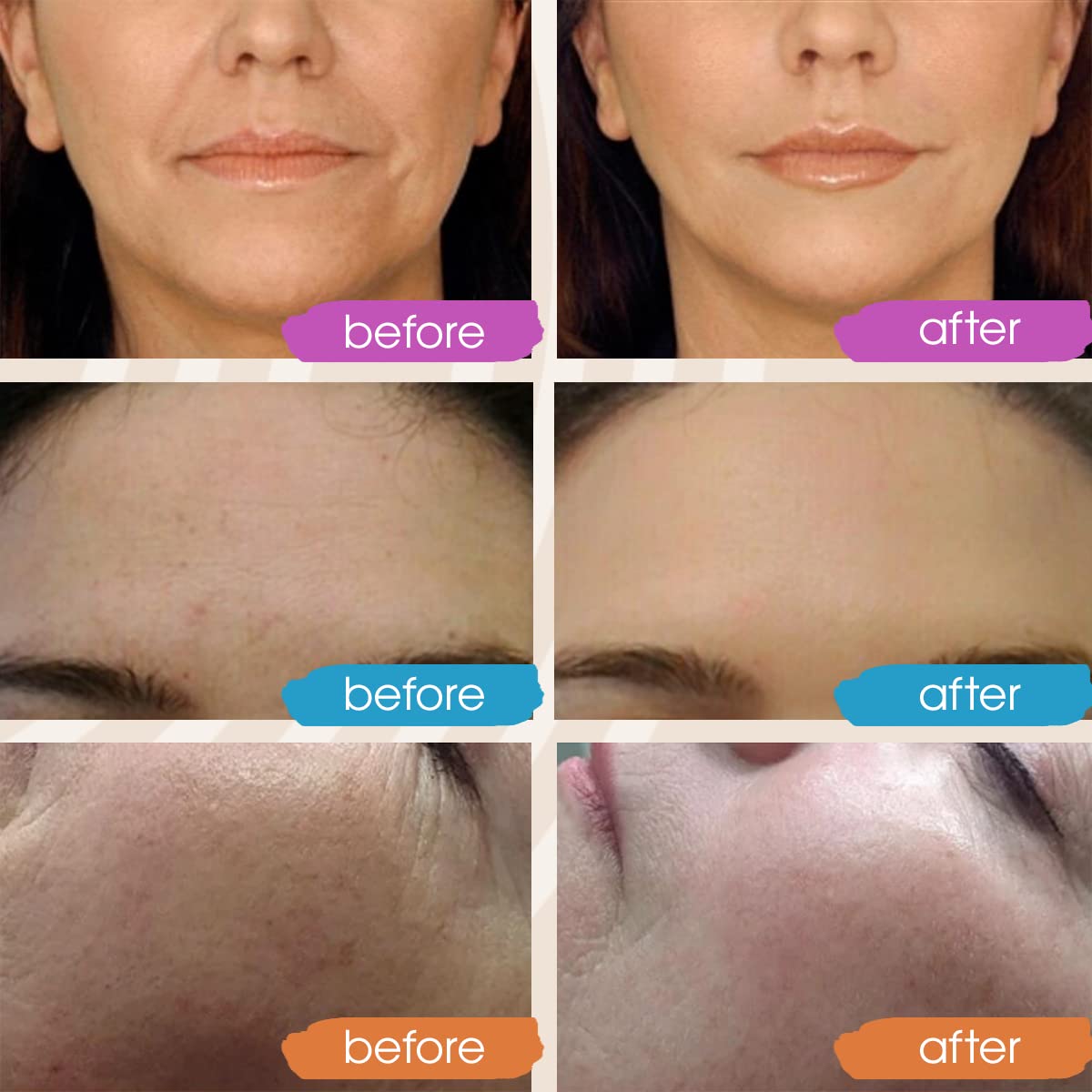 Nuevo Sérum Facial Vitamina C 2024, Hidratante y Iluminador