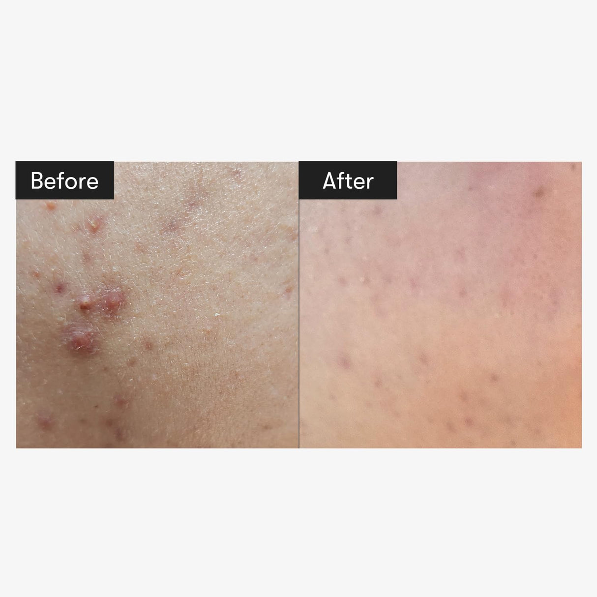 Esencia Facial Diaria Centella, Ácido Hialurónico, Extracto Propóleo