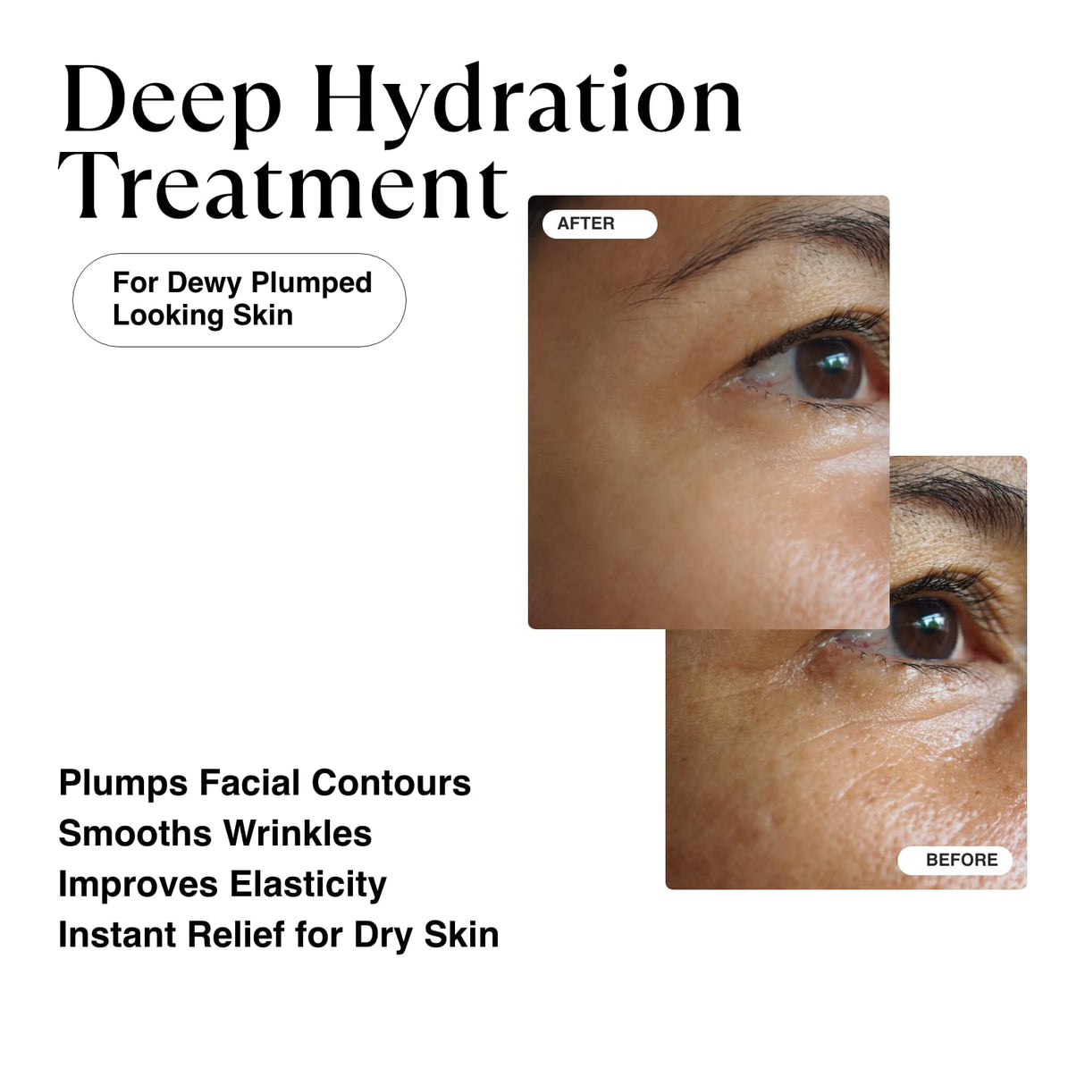 Suero coreano MATKAS de ácido hialurónico triple