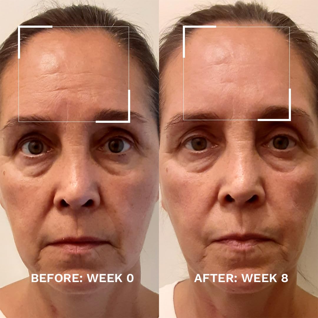 Potenciador para levantar la piel CBSLB City Beauty