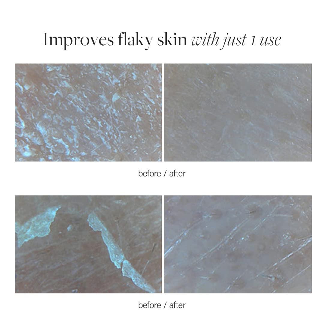 suero facial hidratación profunda