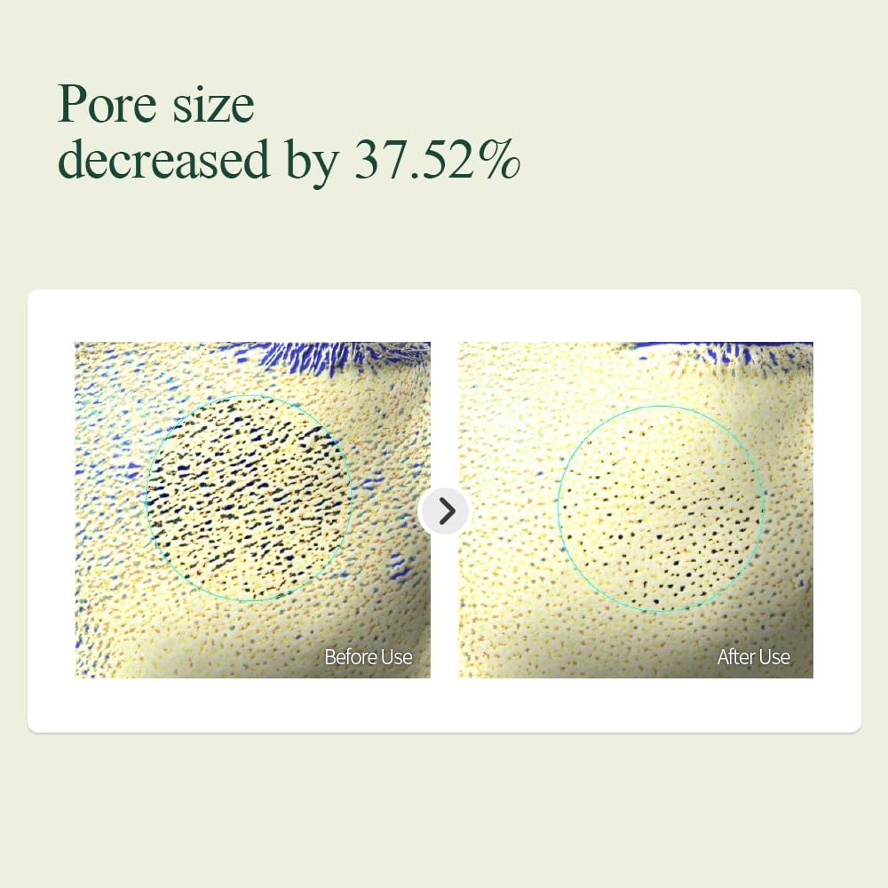 Set de Cuidado Facial Diario Calmante y Vegano para Piel Sensible