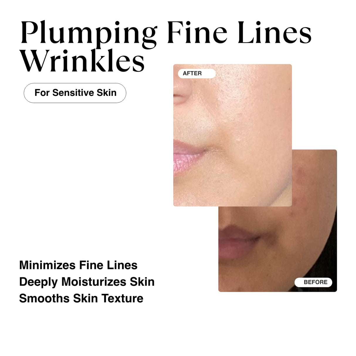 Suero coreano MATKAS de ácido hialurónico triple