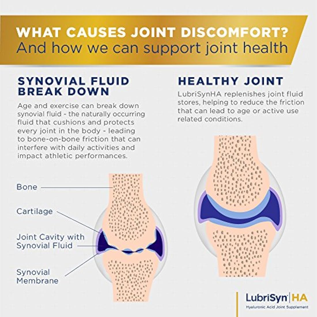 Suplemento humano de articulación