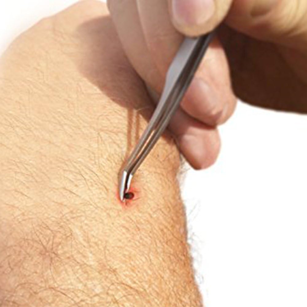 Herramienta para quitar garrapatas eTradewinds, acero inoxidable, 4-Pack