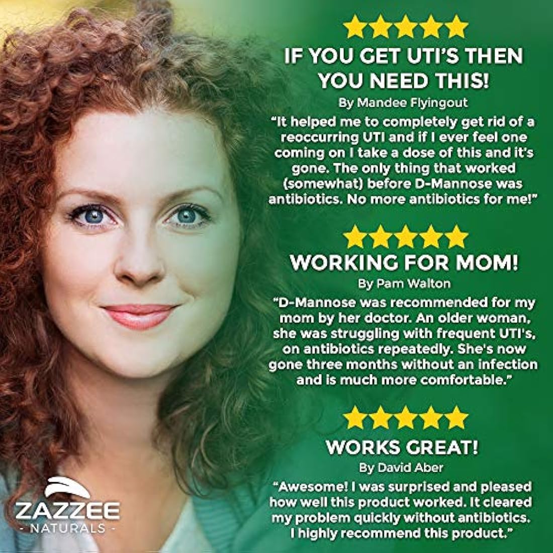 Zazzee D-Mannose Powder Plus, 67 porciones, 6.5 onzas