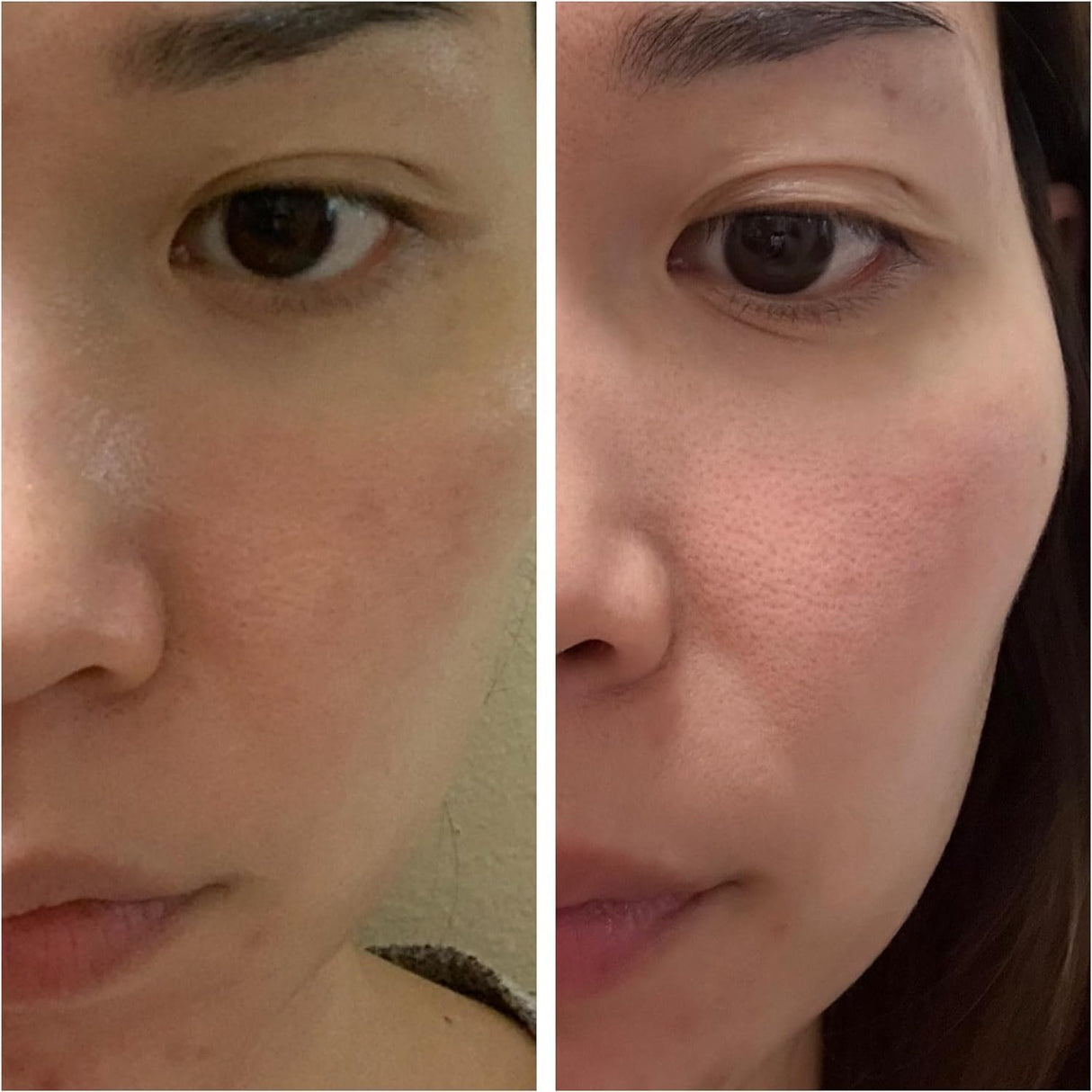 Set de Cuidado Facial Coreano - Kits Simplificados Kbeauty