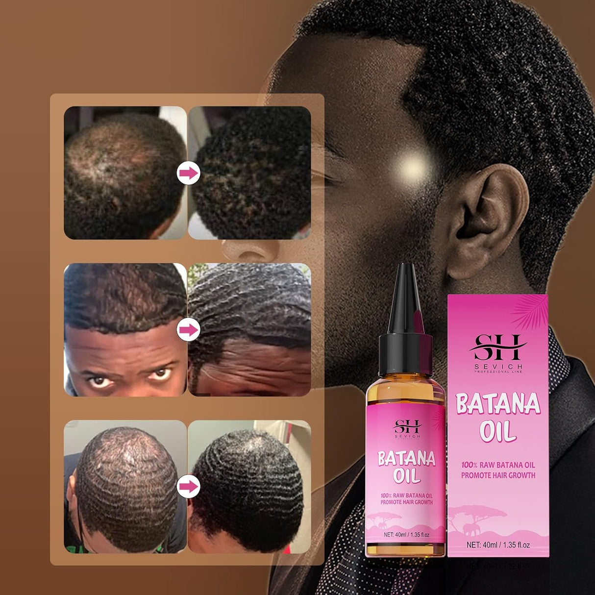 Aceite Batana 100% Natural SEVICH - Nutre y Repara Cabello 1.36 oz