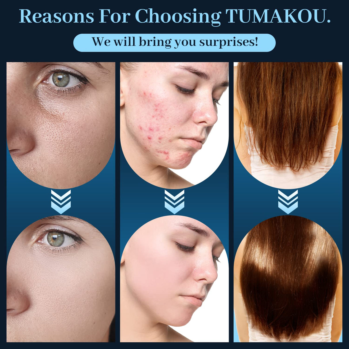 Varita Facial de Alta Frecuencia Portátil con 4 Tubos de Vidrio