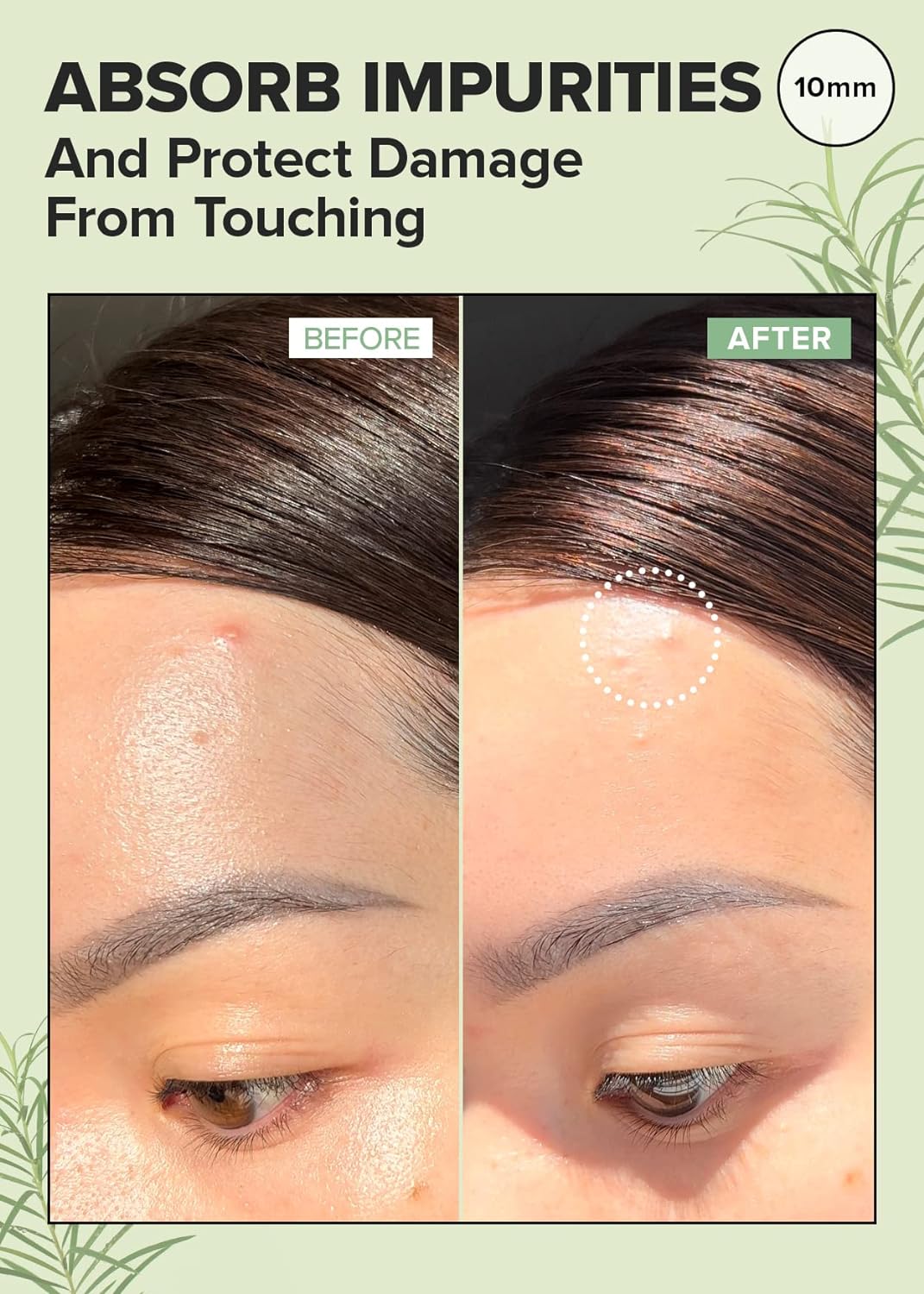 Parche Hidrocoloide para Acné con Árbol de Té, Timeout Blemish