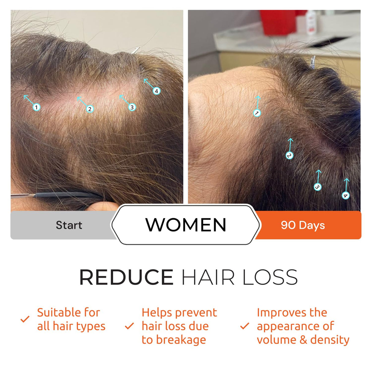 Acondicionador Revita Espesante con Cafeína y Biotina