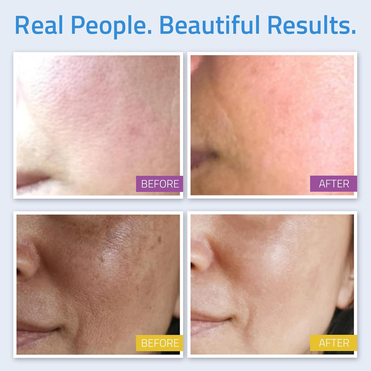 kit de cuidado facial con ácido hialurónico Yeouth