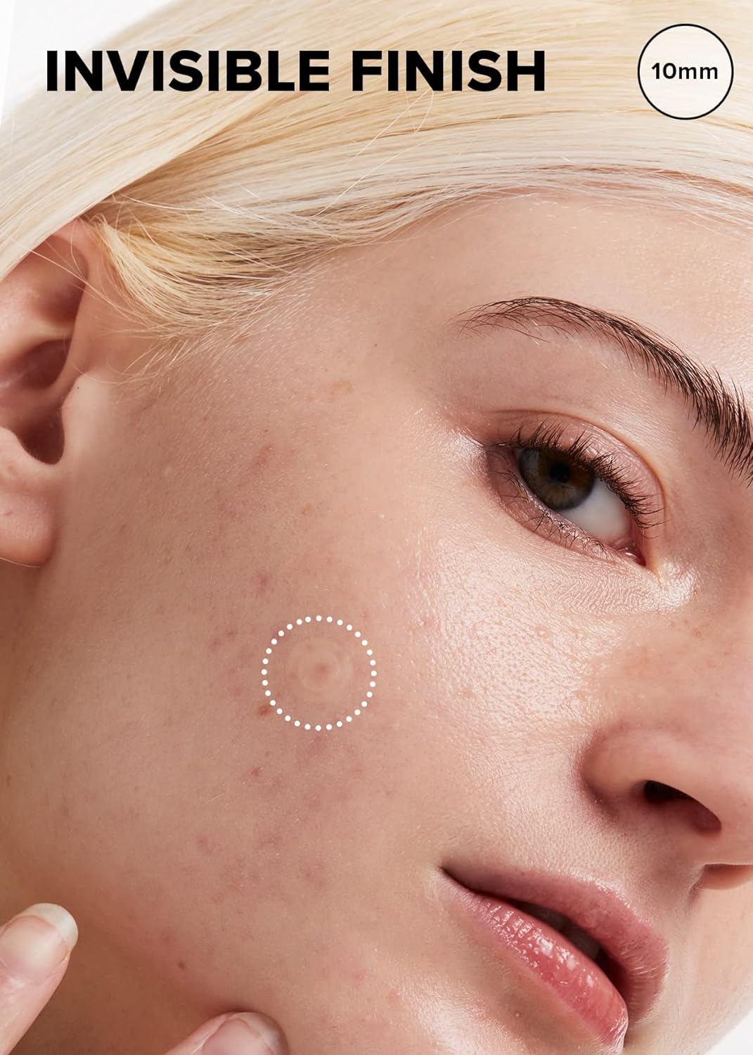 Parche Hidrocoloide para Acné con Árbol de Té, Timeout Blemish