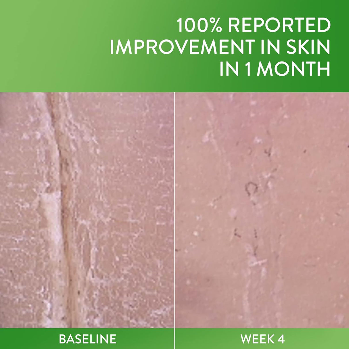 Loción reparadora de piel agrietada Cetaphil sin fragancia