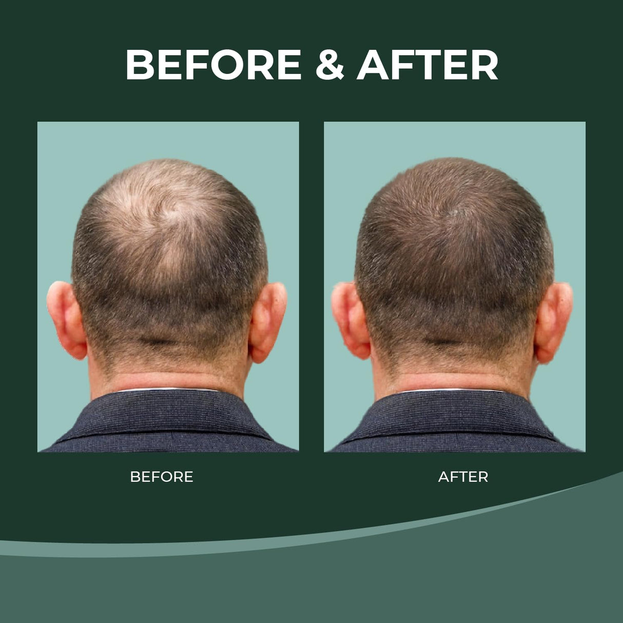 Thik&Fix Spray para el crecimiento del cabello, spray para engrosar el cabello para hombres y mujeres, aumenta el volumen y la textura, humecta el cuero cabelludo y el cabello, reduce los enredos (3.38 onzas líquidas)