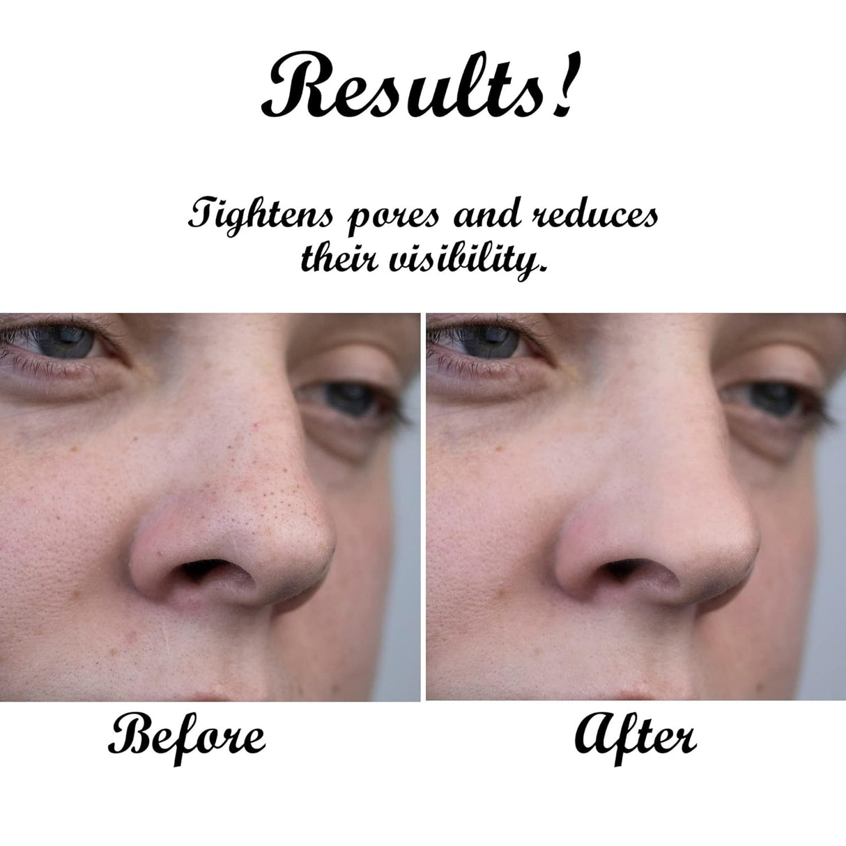 Bálsamo Limpiador Facial Dr. Joe - Hidratante y Desmaquillante