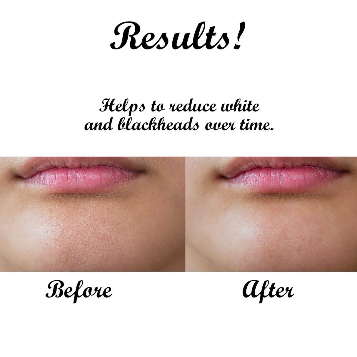 Bálsamo Limpiador Facial Dr. Joe - Hidratante y Desmaquillante