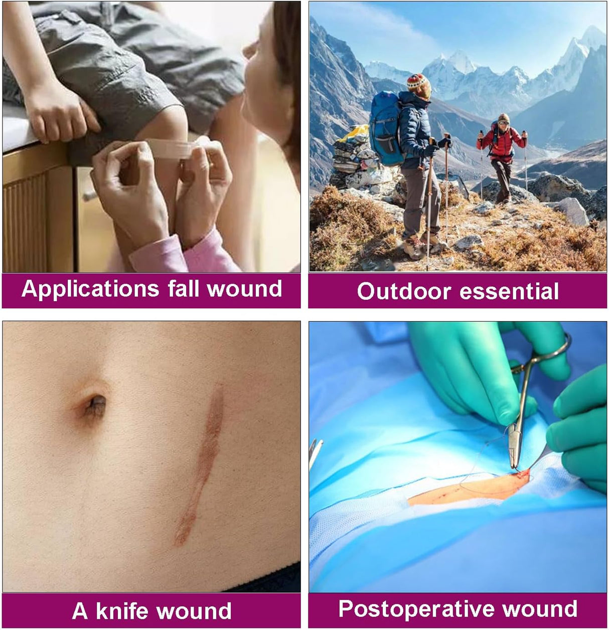 Kit de Cierre de Heridas Sin Puntos, 2 Pcs, Zip Stitch