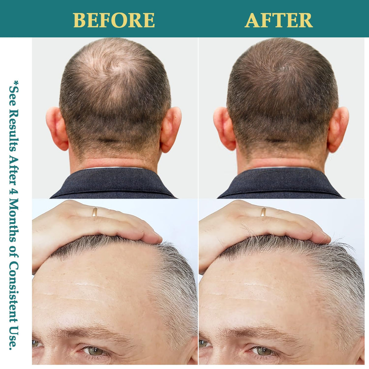 Spray Aceite Crecimiento Natural Batana Romero Biotin 2 FL OZ