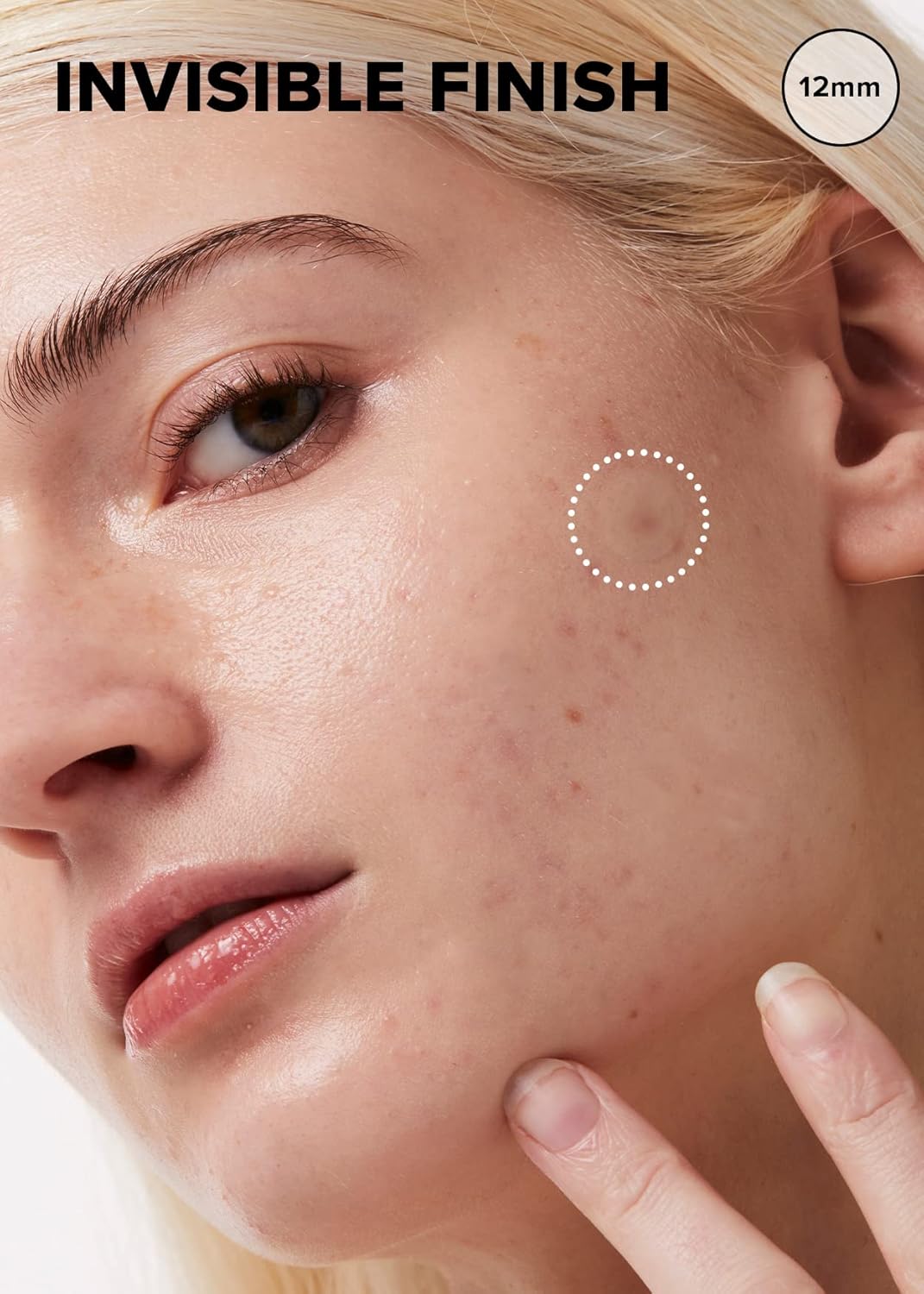 Parche Hidrocoloide para Acné con Árbol de Té -